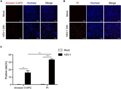 Herpes Simplex Virus 1 Induces Microglia Gasdermin D-Dependent Pyroptosis Through Activating the NLR Family Pyrin Domain Containing 3 Inflammasome